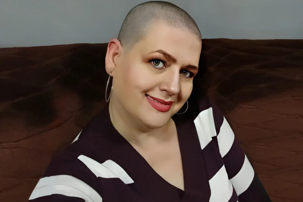 Cirurgia de reconstrução mamária pelo SUS